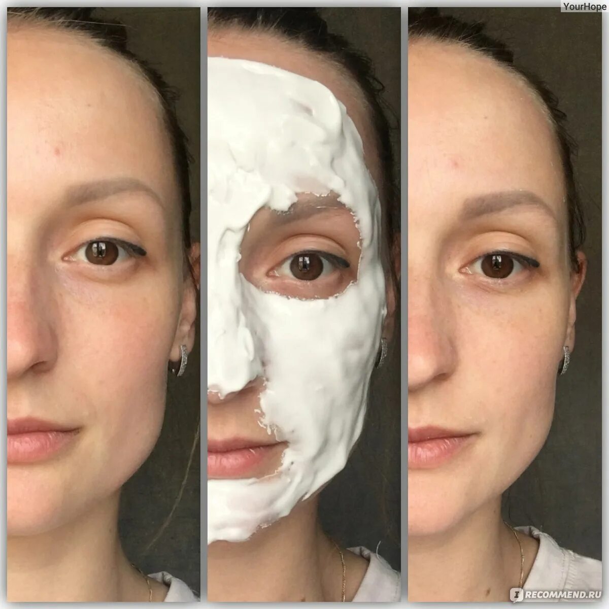 Отзывы про маску. Альгинатные маски для лица до и после. Альгинатная маска до и после. Альдегидная маска для лица. Альгинатная маска эффект.