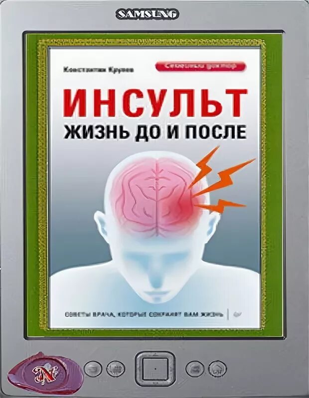 Инсульт и жизнь. Книга жизнь после инсульта. Крулев к. инсульт. Жизнь до и после 2017. Жизнь после инсульта книга pdf.