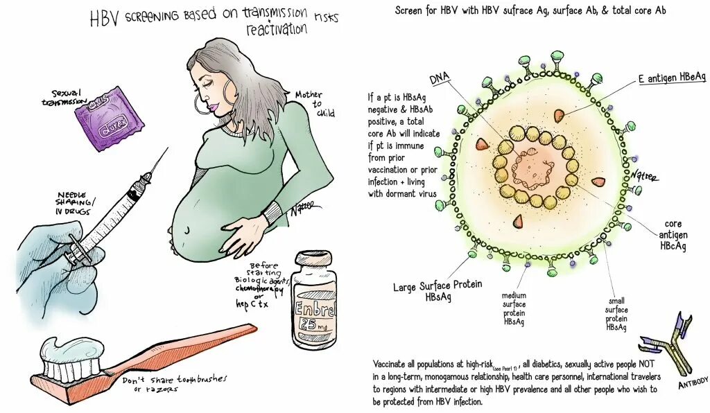 Гепатит во время беременности. Вирусные гепатиты. Вирус гепатита b. Вирусный гепатит е у беременных.