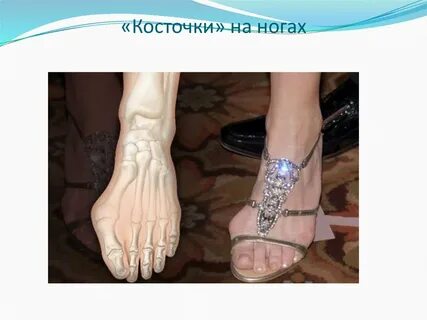 У человека в связи с прямохождением стопа