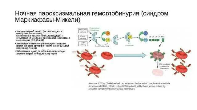 Пароксизмальная гемоглобинурия. Пароксизмальная ночная гемоглобинурия критерии диагноза. Пароксизмальная ночная гемоглобинурия по утвержденным клиническим рекомендациям. Пароксизмальная холодовая гемоглобинурия. Пароксизмальная ночная гемоглобинурия по утвержденным клиническим рекомендациям.
