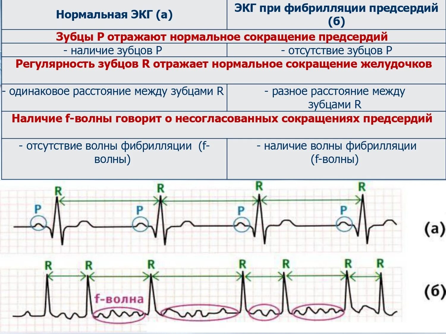 Изменение сердечного ритма