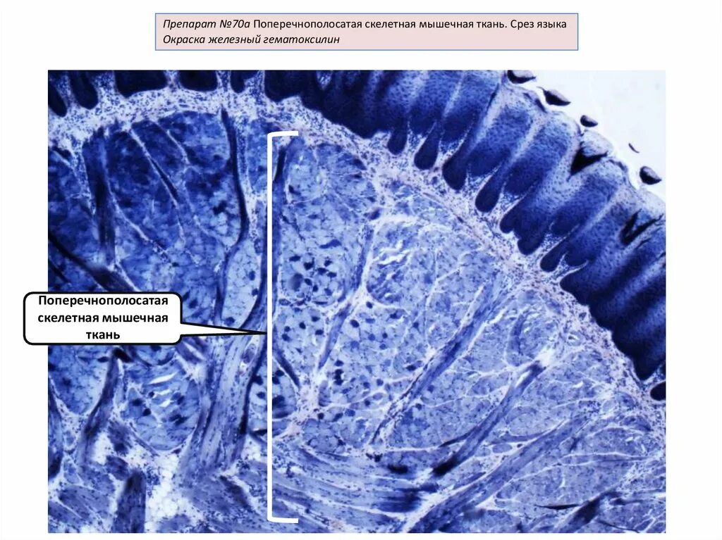 Поперечно-полосатая мышечная ткань языка Железный гематоксилин. Поперечно полосатая мышечная ткань Железный гематоксилин. Поперечно полосатая мышечная ткань Железный гематоксилин гистология. Поперечно полосатая мышечная ткань языка гематоксилин. Препарат поперечно полосатая мышечная ткань