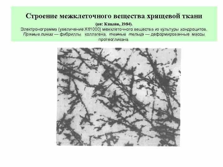Межклеточное вещество строение функции. Межклеточное вещество хрящевой ткани. компоненты межклеточного вещества хрящевой ткани. строение межклеточного вещества хрящевой ткани. состав межклеточного вещества хрящевой ткани.