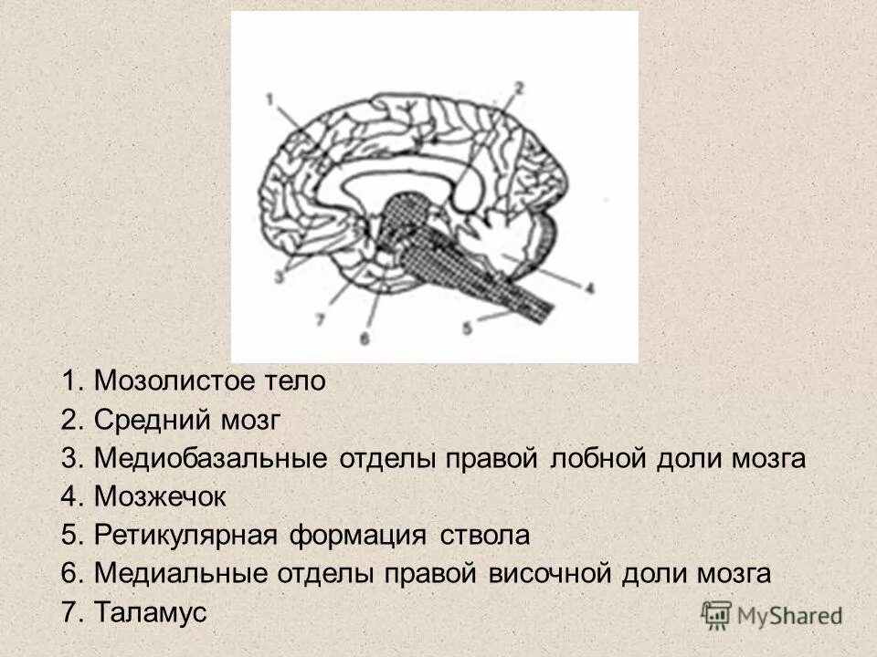 медиобазальные отделы височной доли
