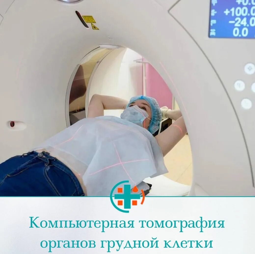 Компьютерная томография ковид 19. Как делают кт легких видео. Rn легких. Кт легких. Rn легких.