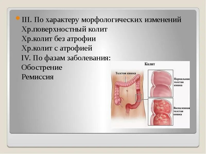 Хронический колит симптомы.