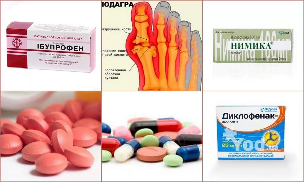 Медикаменты при подагре
