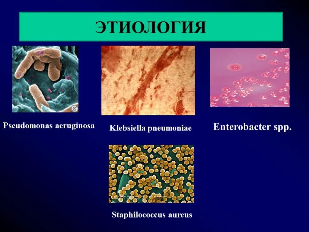 Условно-патогенные энтеробактерии klebsiella. Enterobacter spp. Кишечная палочка клебсиелла протей. Enterobacter spp. Бактерии семейства enterobacteriaceae.