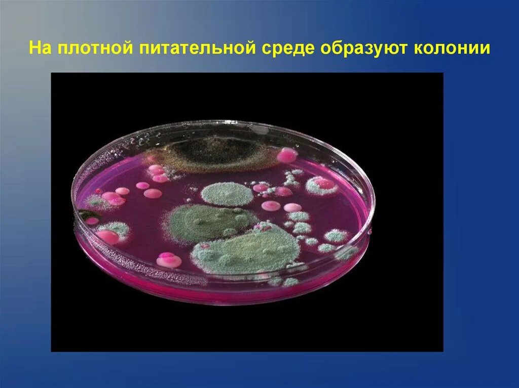 Бактерии в бескислородной среде. Плотные питательные среды микробиология. Среды питательной среды в микробиологии. Плотные и жидкие питательные среды микробиология. Плотные питательные среды для бактерий.