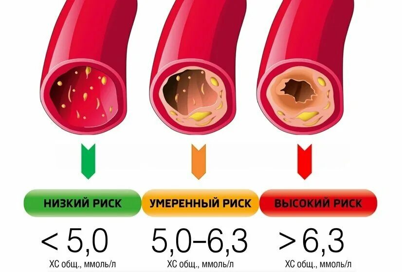 Повышенный сахар у мужчин причины. Уровень холестерина в крови. Высокий показатель холестерина. Крлвнгь холестерина в крови. Опасный уровень холестерина.