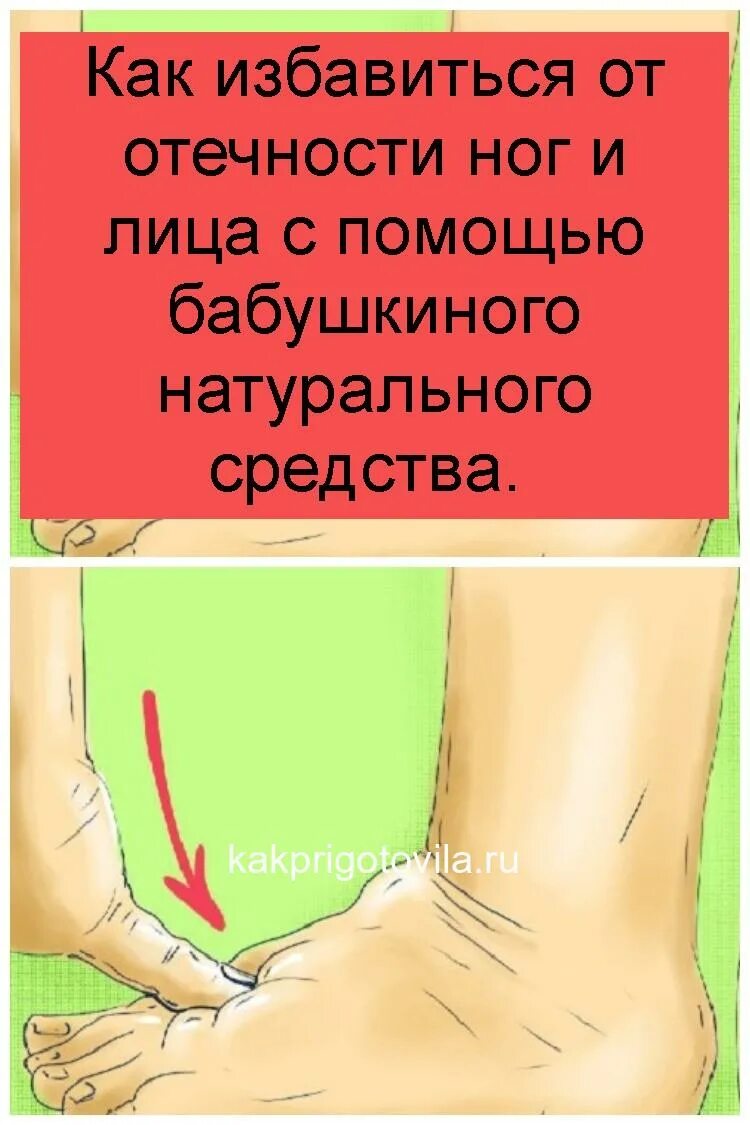 Можно ли пить при отеках ног. Народное средство от отеков. Избавление от отеков на ногах. Как избавиться от отеков. Как избавиться от отеков ног.