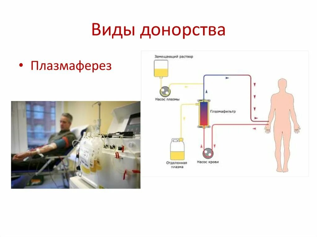 Плазма крови плазмаферез. Виды донорства. Донорский плазмаферез. Донорство виды донорства. Виды доноров