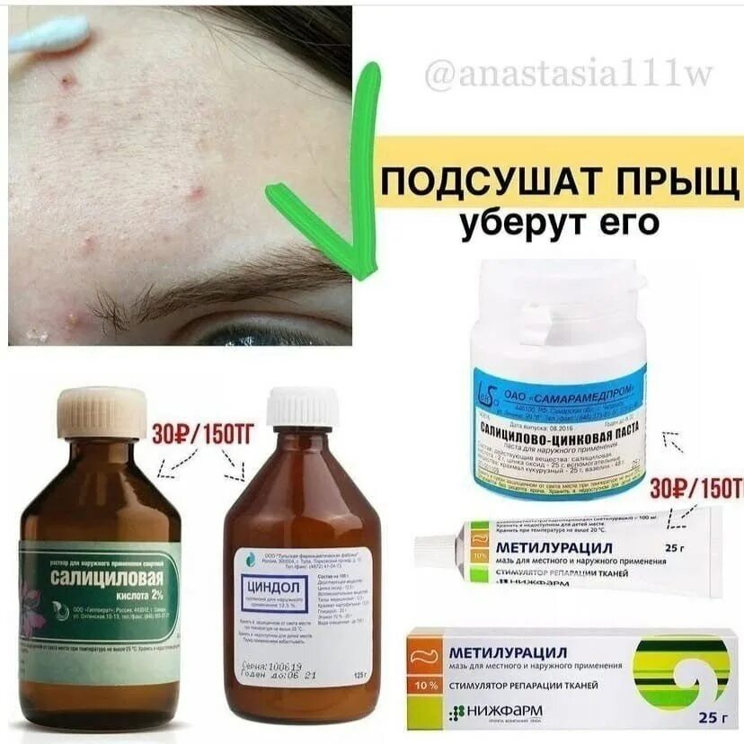 От прыщей на лице дома. Методы избавления от прыщей. средства для избавления от прыщей. средства от избавления прыщей на лице. какизбавится от прыщей.