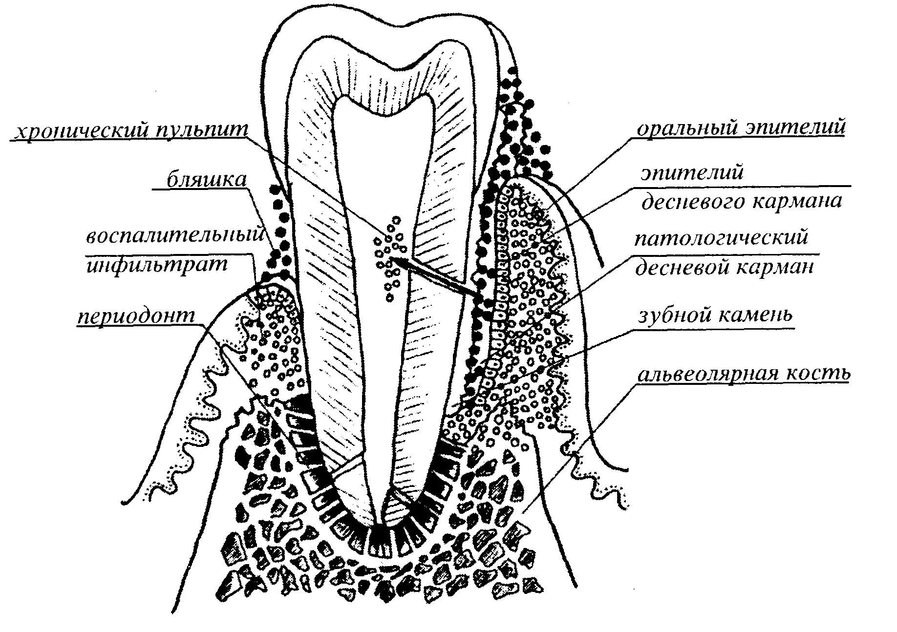 Строение периодонта гистология. Строение периодонта схема. Строение периодонта и пародонта зуба. Схема строения пародонта. Альвеолярная десна