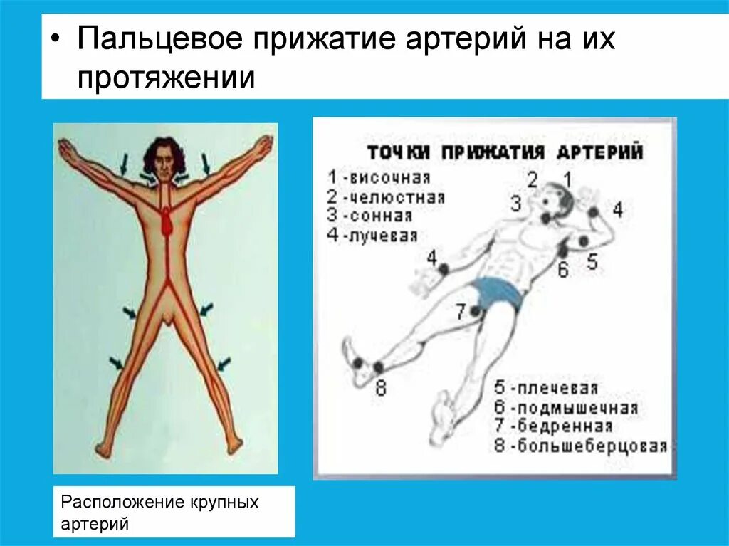 Пальцевое прижатие артерий. Пальцевое прижатие артерий на протяжении. Осуществить пальцевое прижатие артерий. Прижатие сосуда на протяжении.