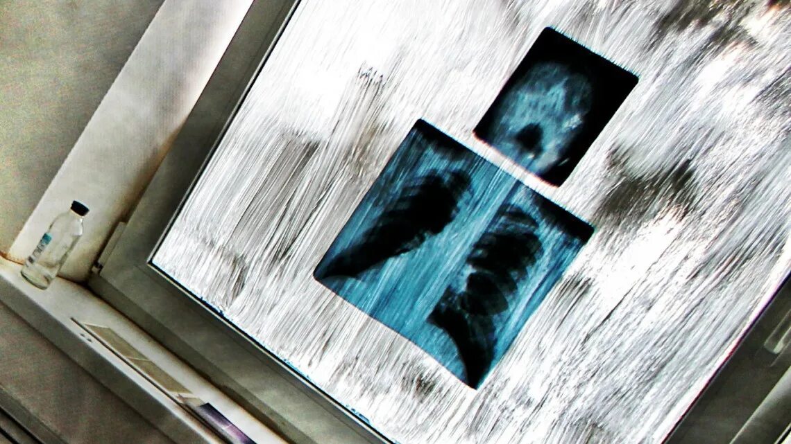 квест психбольница нижний новгород. квест психиатрическая больница архангельск. квест психбольница новокузнецк. квест психбольница волгоград. квесты вологда психбольница.