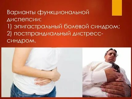 Эпигастральный инфаркт