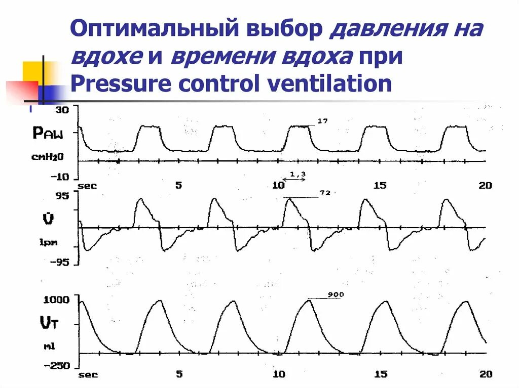 Давление на вдохе. Мониторинг вентиляции легких. Давление вдоха ИВЛ. Положительное давление на вдохе.