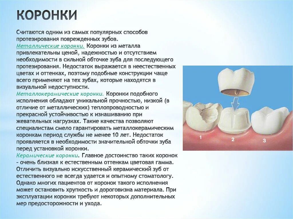 Какую функцию выполняет коронка зуба. Материал коронок для зубов. Коронка на зуб металлокерамика.