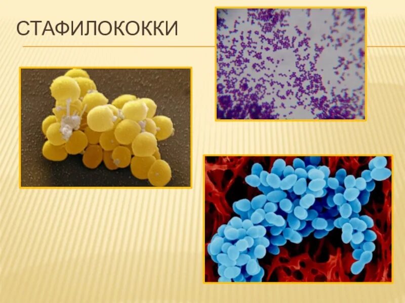 Как выглядит стафилококк. Гноеродные бактерии (стафилококки). коагулазопозитивные стафилококки. кокки бактерии стафилококки. коагулазоположительный стафилококк.