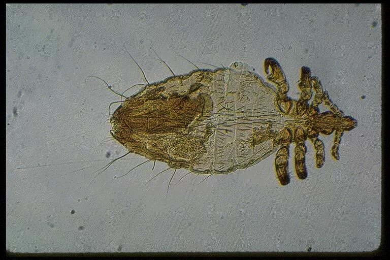 Flashcards Table on Parasitology