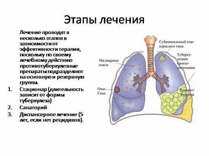 Лечение на разных стадиях