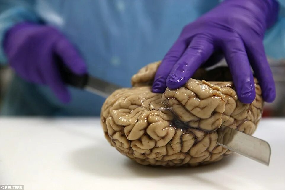 La ciencia ya sabe cómo volver a la vida el cerebro de un humano muerto (pero el