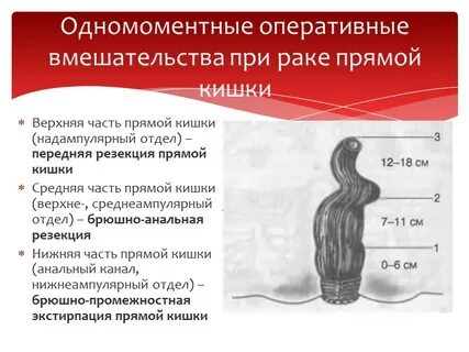 Запах прямой кишки