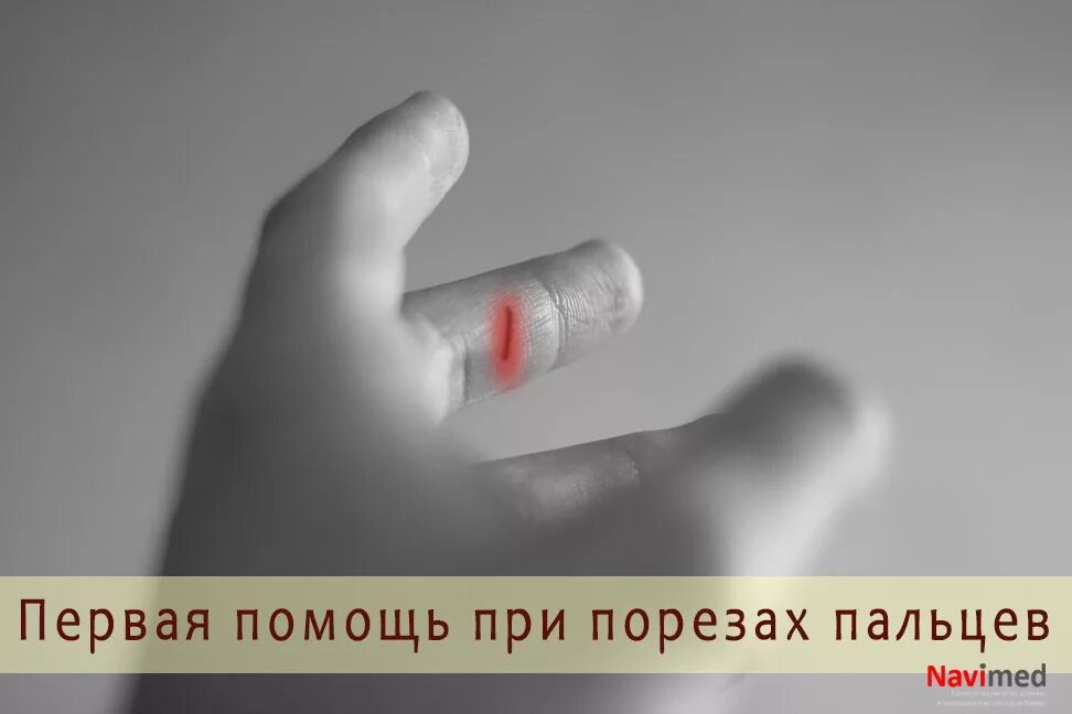 Первая помощь при порезе стеклом. Первая помощь при порезах пальцев. оказание первой помощи при порезе пальца. оказать первую помощь при пореще пальцы. 1 помощь при порезе пальца.