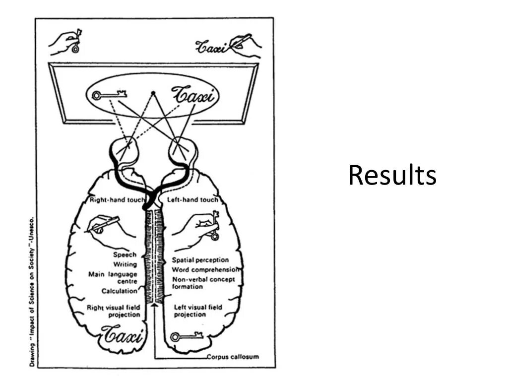 Split brain. Эксперимент Сперри. Газзанига расщепленный мозг. Хенд тач схема.