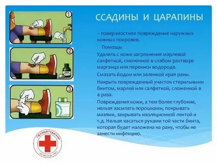 2 первая помощь при ушибах
