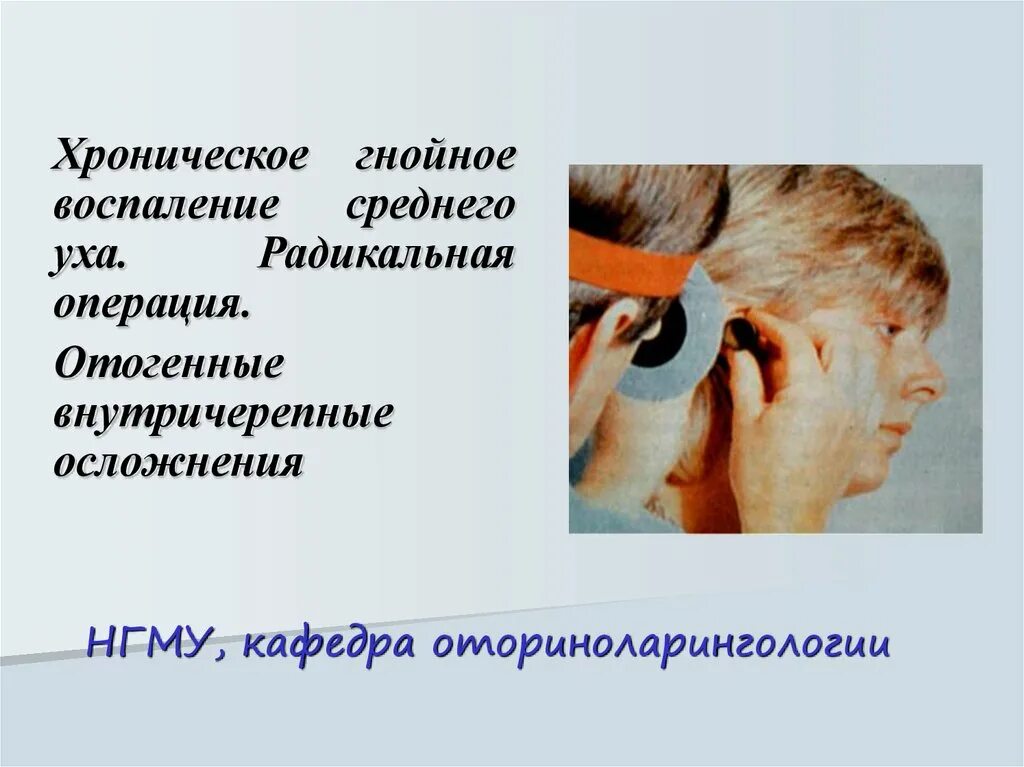 Воспаление среднего уха операция. Осложнения среднего уха. Хроническое гнойное воспаление среднего уха. Радикальная операция на ухо. Операция на среднем ухе