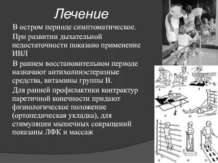 Лечение полиомиелита