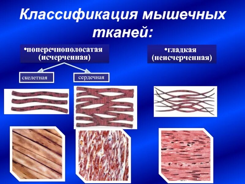 Отличие гладкой и поперечно полосатой ткани. Исчерченная мышечная ткань гистология. Поперечнополосатая мышечная ткань строение гистология. Сердечная поперечно-полосатая исчерченная ткань. Морфофункциональная классификация мышечных тканей гистология.