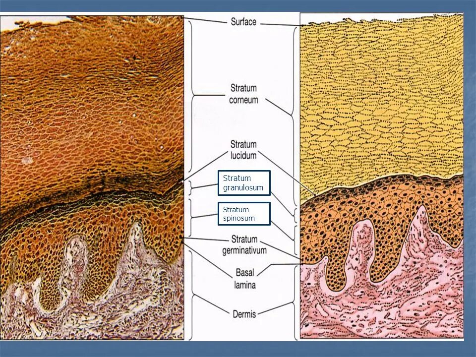 Stratum перевод. Stratum spinosum. stratum granulosum. stratum granulosum особенности. каковы особенности stratum granulosum.