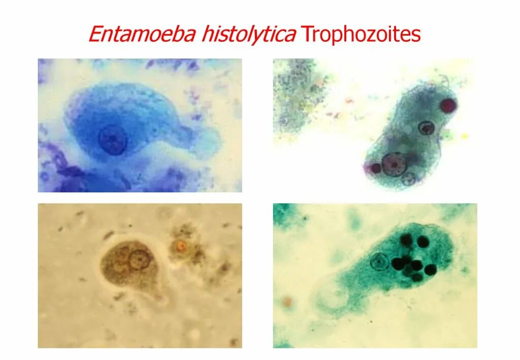 Стадия амебы поражающая толстый кишечник человека. Entamoeba histolytica циста. Entamoeba histolytica заболевание. Вегетативная форма Entamoeba histolytica. Дизентерийный амебиаз симптомы.