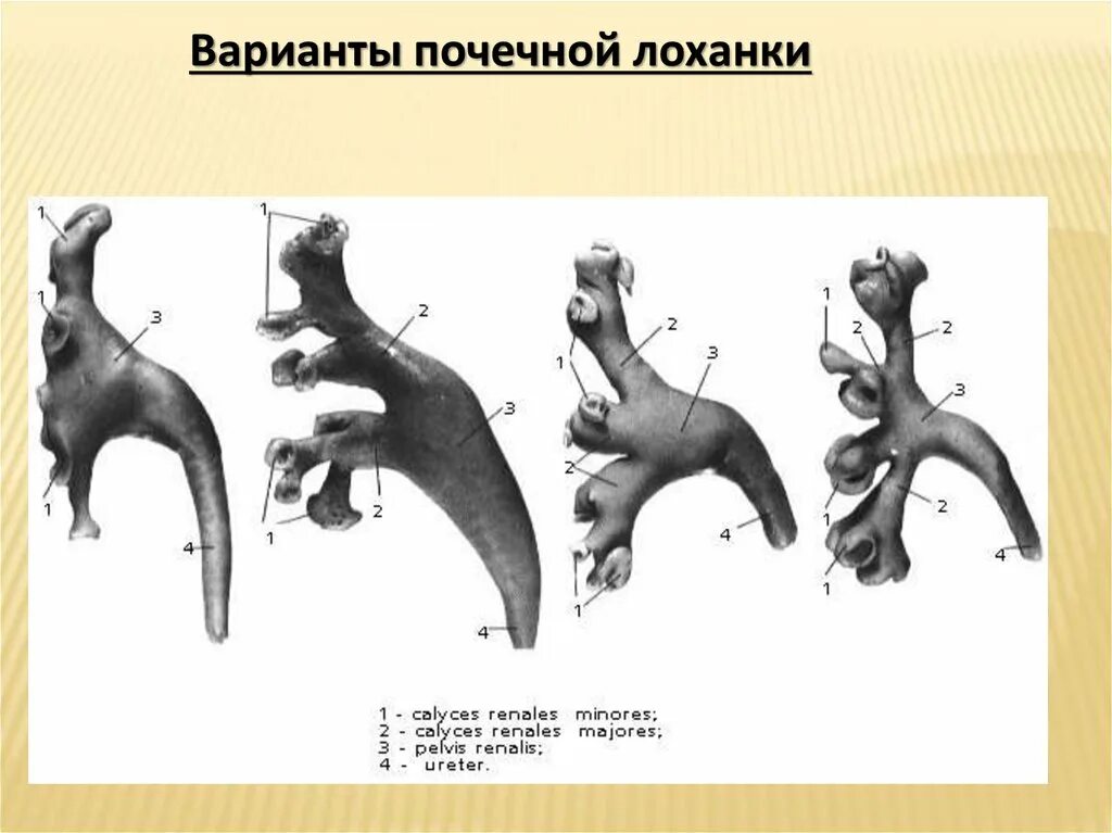 Варианты строения почечной лоханки. Варианты строения чашечно лоханочной системы. Типы почечных лоханок.