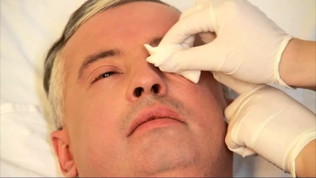 Уход за глазами ушами. Обработка глаз тяжелобольного пациента. Промывание глаз пациенту. Уход за глазами тяжелобольного пациента.