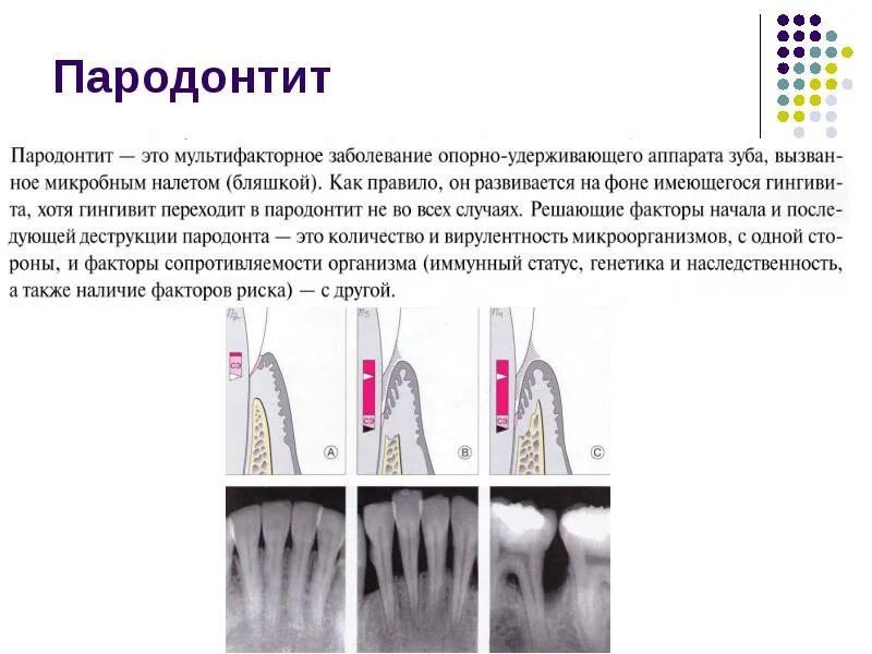 Классификация пародонта. Пародонтит классификация. пародонтит характеристика. пародонтит средней степени тяжести мкб 10. пародонтит презентация.