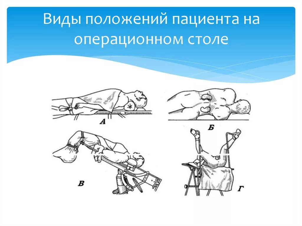 Положение больного на столе. Положение Фовлера на операционном столе. Положение больного на операционном столе. Расположение пациента на операционном столе. Положения при операциях.