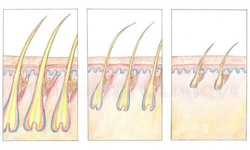 Алопеция волосяной фолликул. Волосяные луковицы на голове. Волос с волосяной луковицей. Луковица волоса.