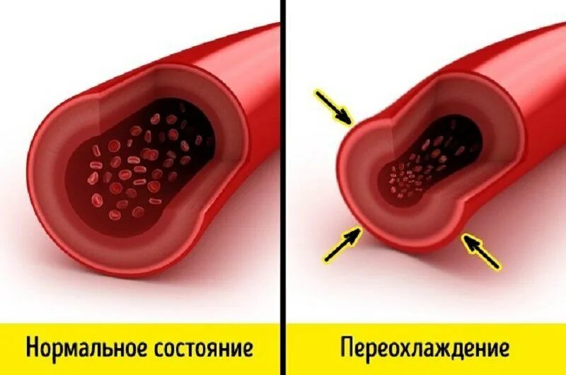 Сужение и расширение сосудов. Спазм кровеносных сосудов. Расширение сужение кровеносных сосудов кожи