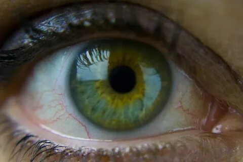 Different eye