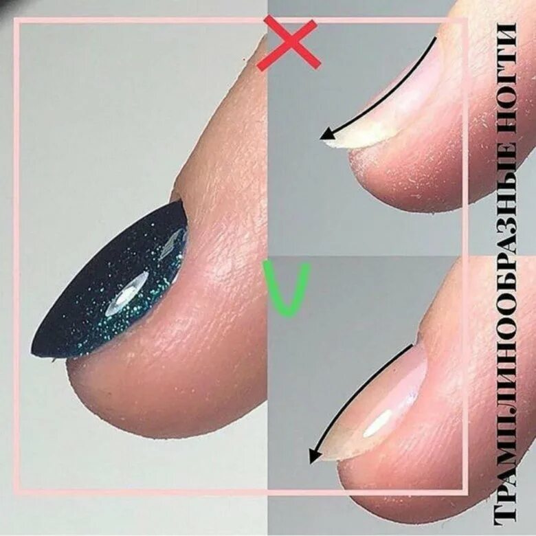Ногти наверх. Маникюр дизайн. Трамплинообразные ногти. Ногти наверх. Ногти наверх.