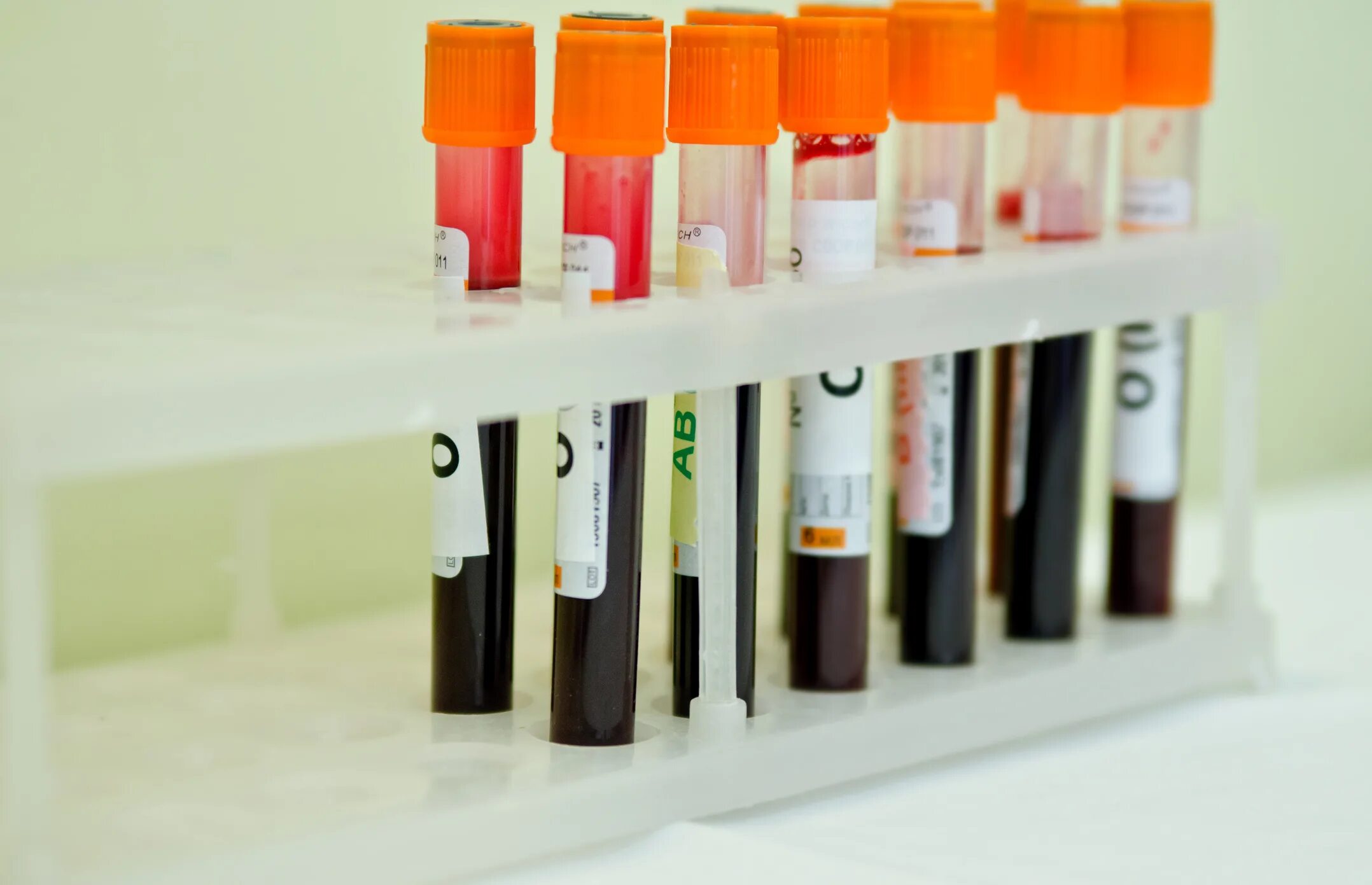 Содержимое пробирки. Содержимое пробирки. Маркировка вакуумных пробирок для взятия крови. Bactec mgit 960/320 пробирки. Содержимое пробирки.