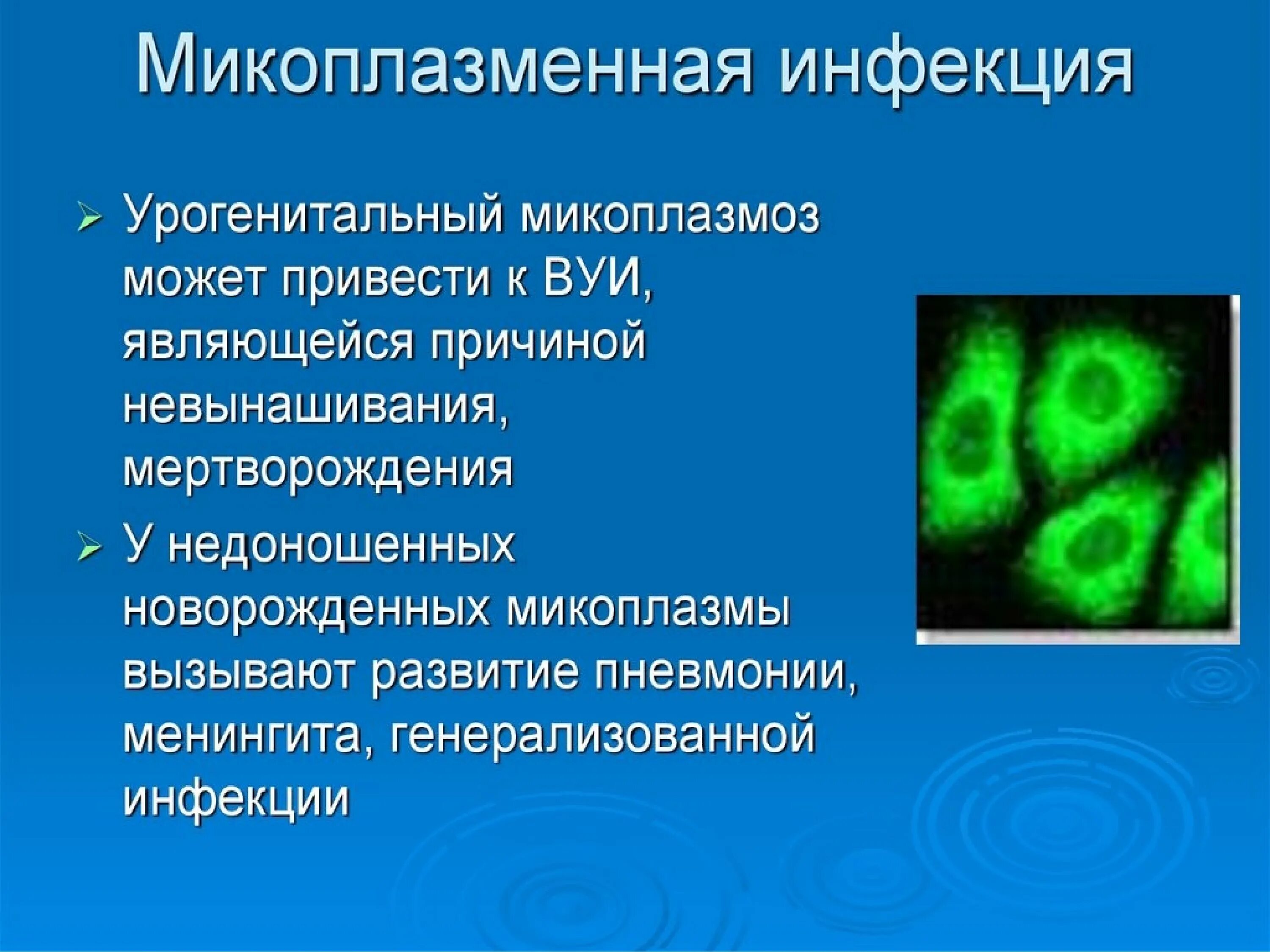 Микоплазма зев. Урогенитальная микоплазменная инфекция. Респираторная микоплазма. Болезни вызываемые микоплазмами.