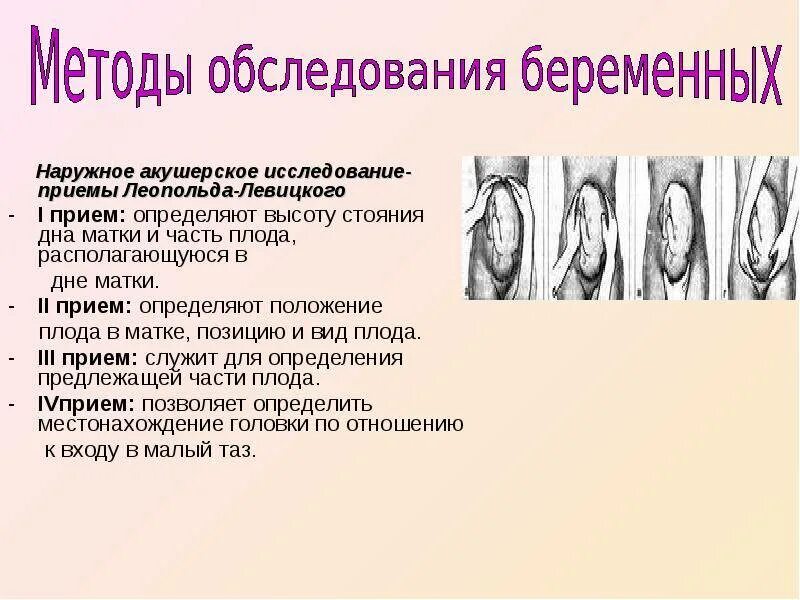 Приемы леопольда алгоритм. Приёмы леопольда левицкого в акушерстве. приемы наружного исследования беременной. приемы наружного акушерского исследования леопольда левицкого. приемы наружного акушерского исследования беременной алгоритм.