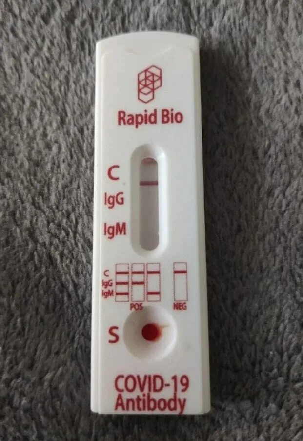 Тест рапид био на коронавирус расшифровка. Экспресс тест на ковид rapid test. положительный тест на коронавирус экспресс тест. экспресс тест на covid 19 положительный. экспресс тест на ковид rapid bio расшифровка.