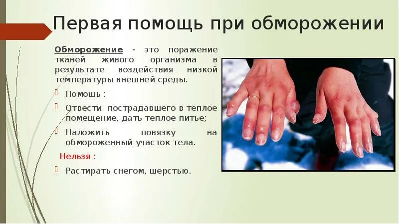 Последовательность помощи при обморожении